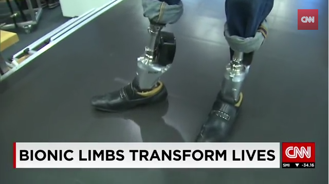 Will These Bionic Limbs Bring a World Without Disability? Thumbnail