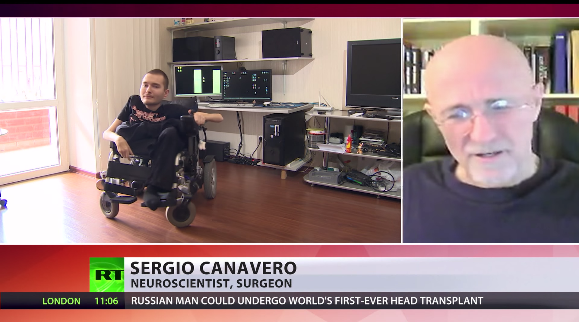 First Ever Human Head to New Body Transplant Planned Thumbnail