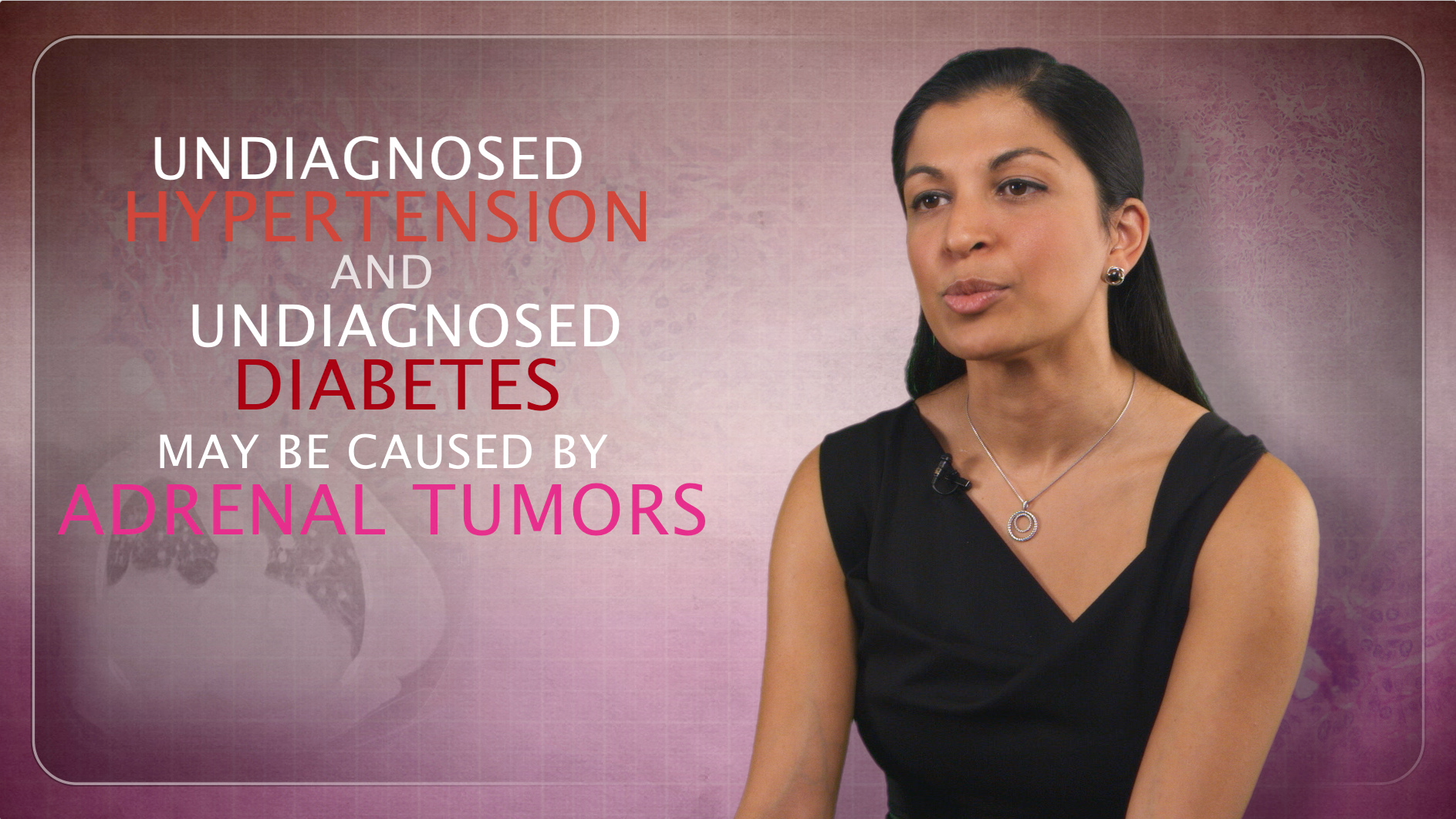 Adrenal Tumors Can Cause Severe Hypertension & Diabetes Thumbnail