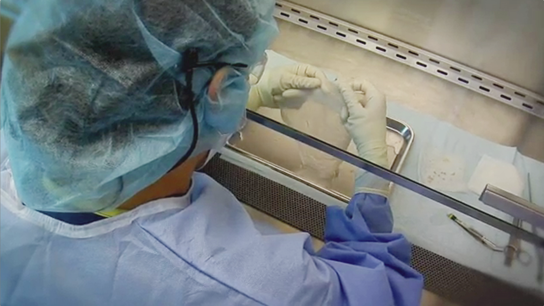Advanced Skin Substitutes Developed from Placental Tissue Thumbnail