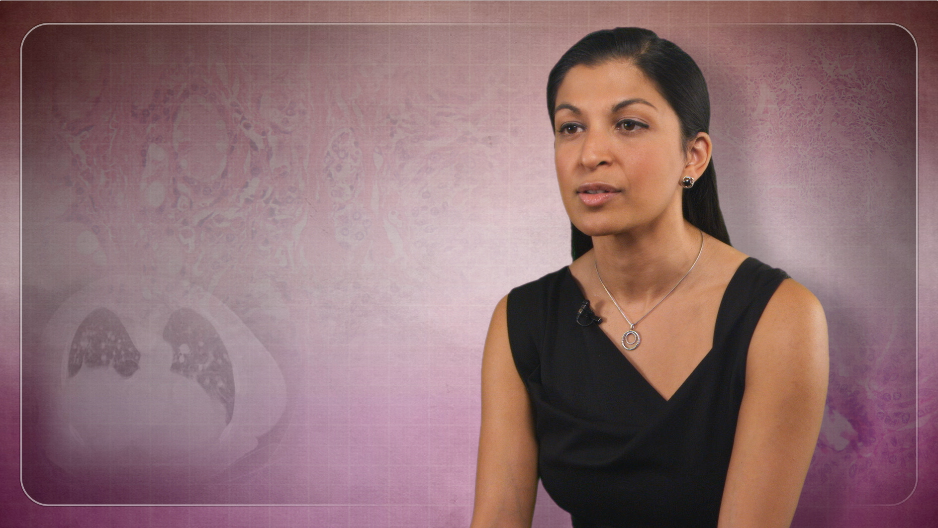 Primary Hyperparathyroidism Identification & Treatment Thumbnail