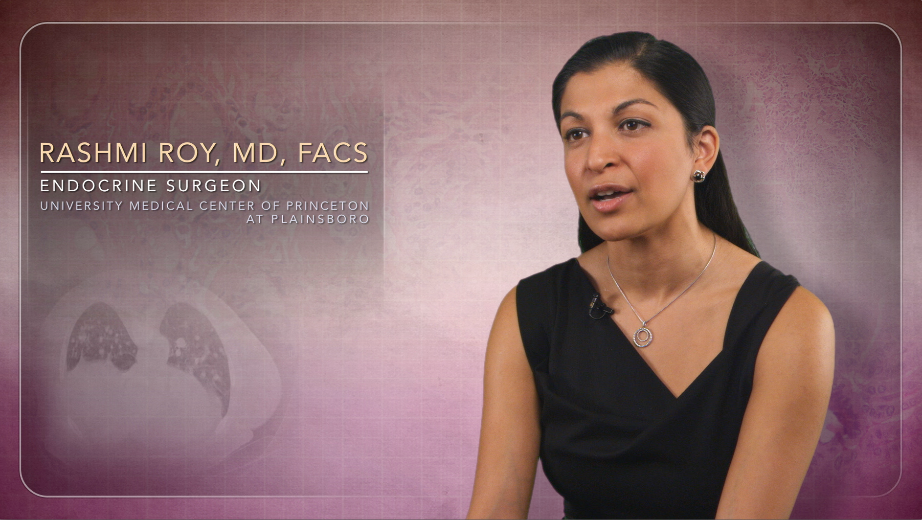 Doctors Find Increasing Rates of Thyroid Cancer Among Women Thumbnail