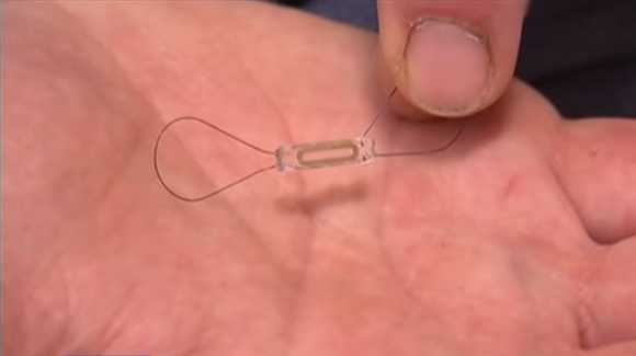 Implantable Cardiac Microchip Anticipates Worsening Heart Conditions Thumbnail
