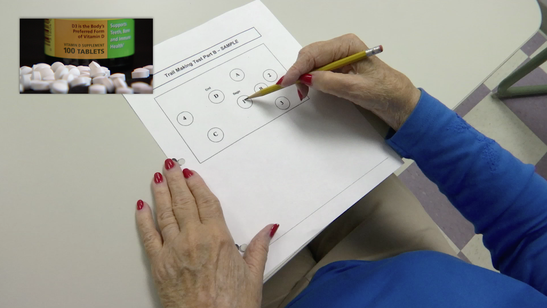 Low Vitamin D Associated with Faster Decline in Cognitive Function Thumbnail