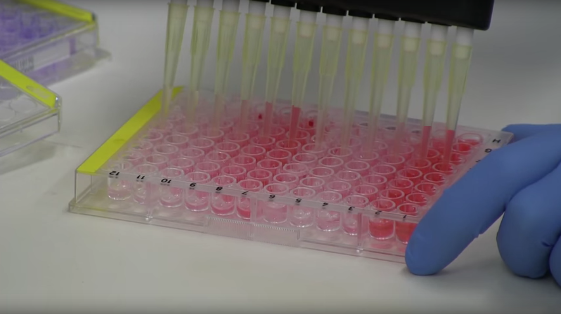Cure for Cachexia May Increase Survivorship Rates for Cancer Patients Thumbnail