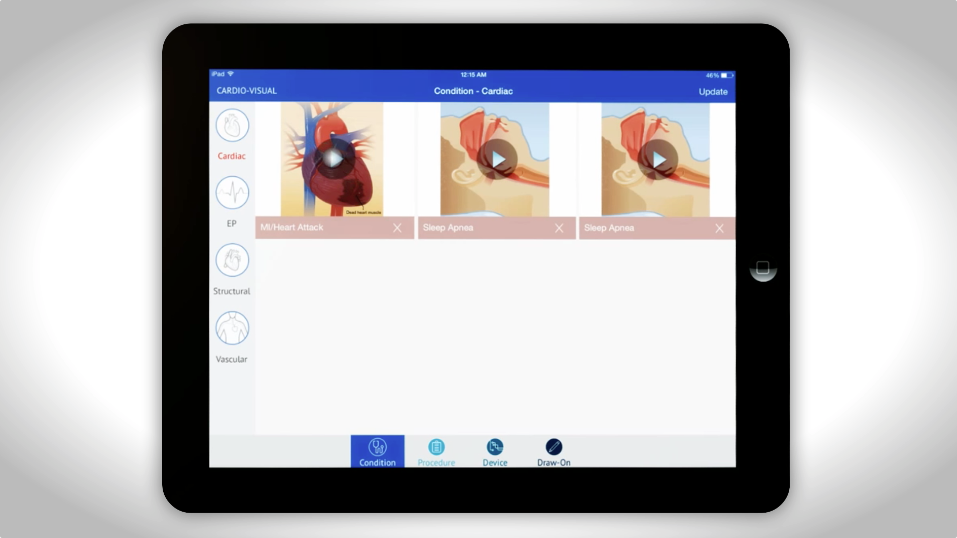Cardio-Visual App Can Help Improve Patient Satisfaction Thumbnail