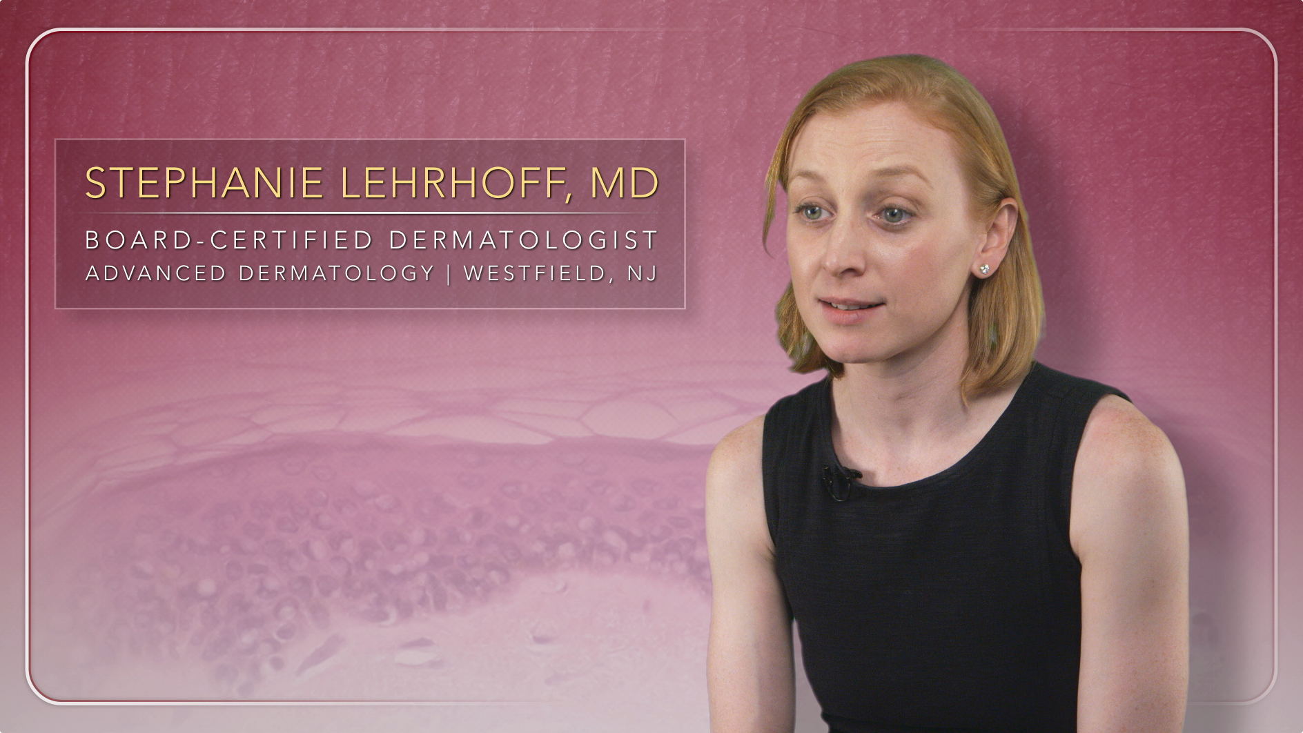 Treatment Options for Severe Cases of Hidradenitis Suppurativa Thumbnail