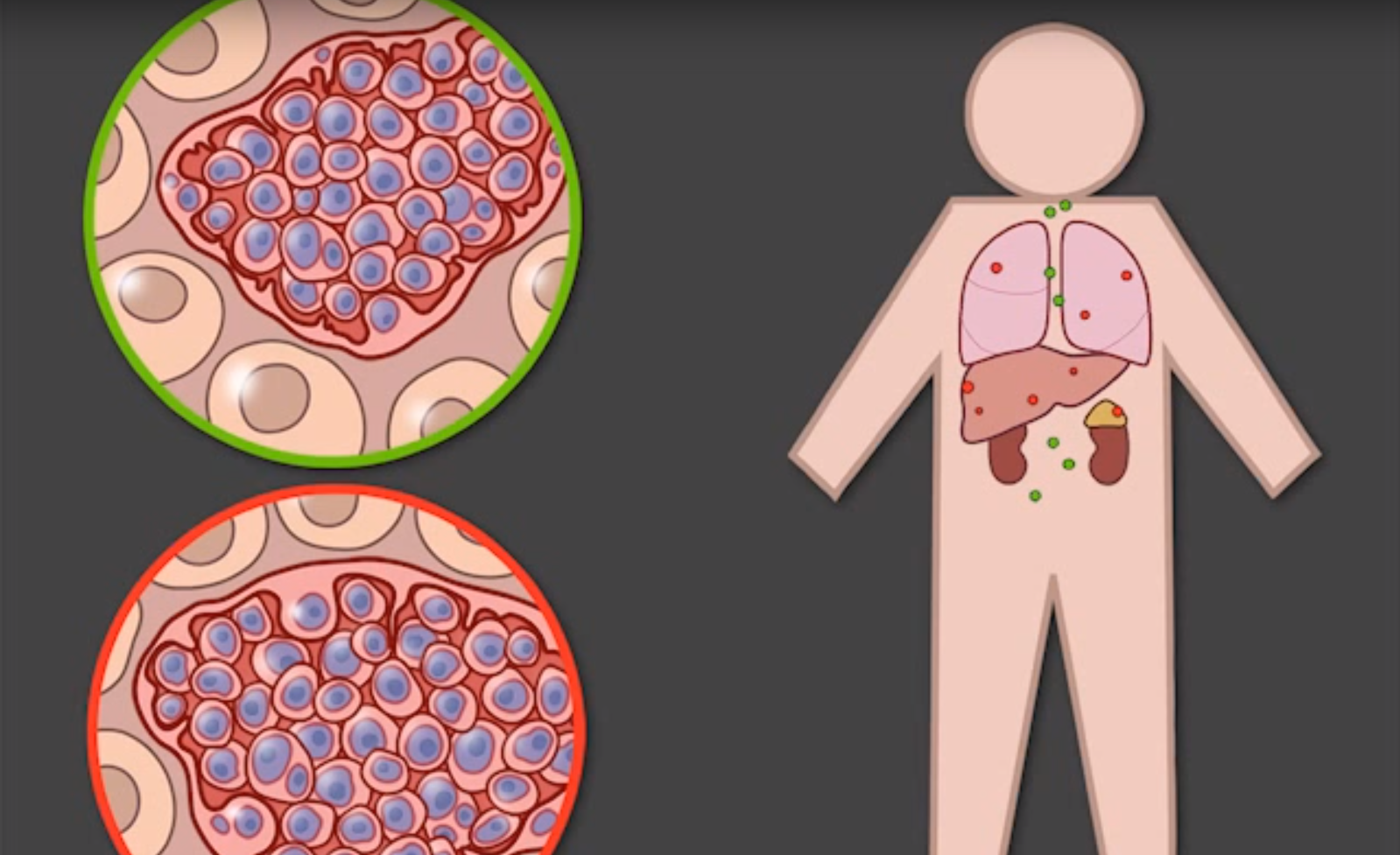 Parasite Spreads Contagious Interspecies Cancer Cells Thumbnail