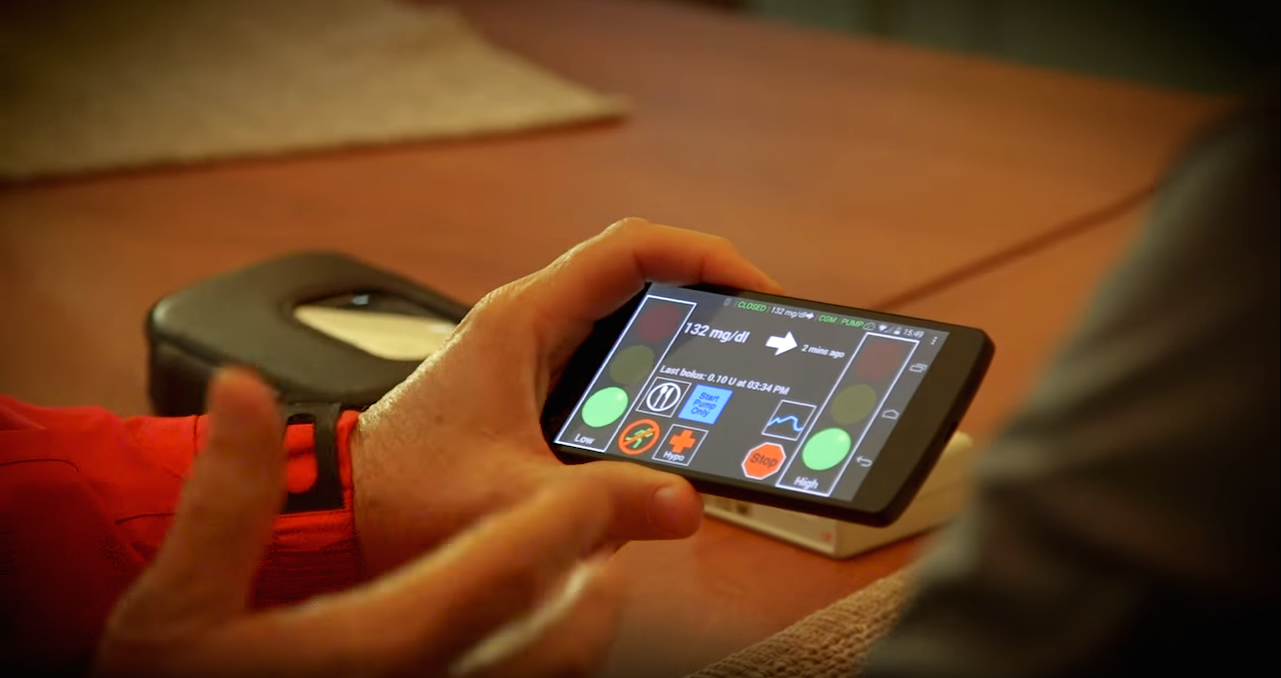 Scientists Create Artificial Pancreas from Triangle of Mobile Devices Thumbnail