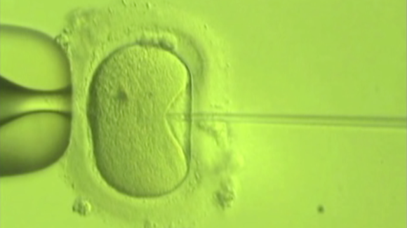 Increased Number of IVF Cycles May Be Beneficial Thumbnail