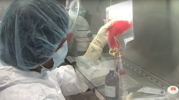 Stem Cell Treatment May Cure Severe Combined Immunodeficiency Thumbnail