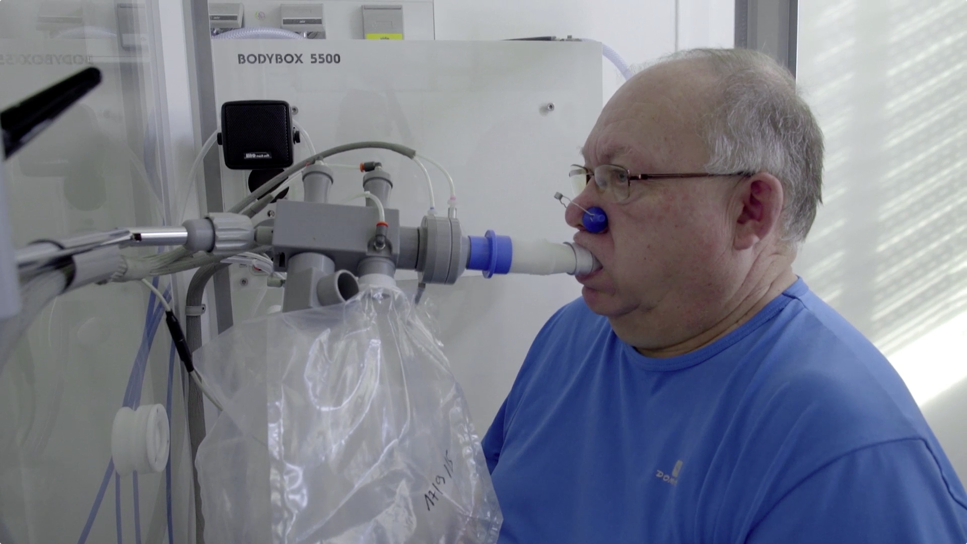 Lung Coil Procedure Helps Patients with Severe Emphysema Thumbnail