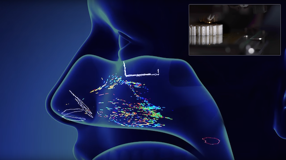 Fluid Dynamics & 3D Models to Reduce Sinus Surgery Complications Thumbnail