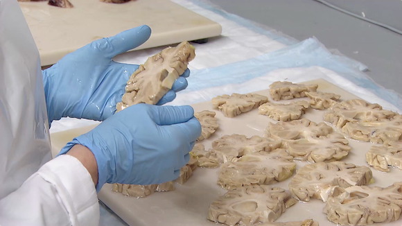 Eating Seafood May Help Lower the Risk of Dementia Thumbnail