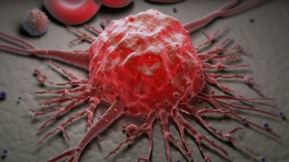 Reprogramming Patients’ T-Cells Yields Cancer-Killer Armies Thumbnail