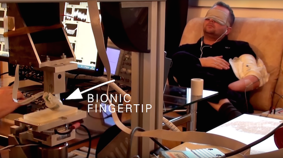 Bionic Fingertip Research Could Return Sense of Touch to Amputees Thumbnail
