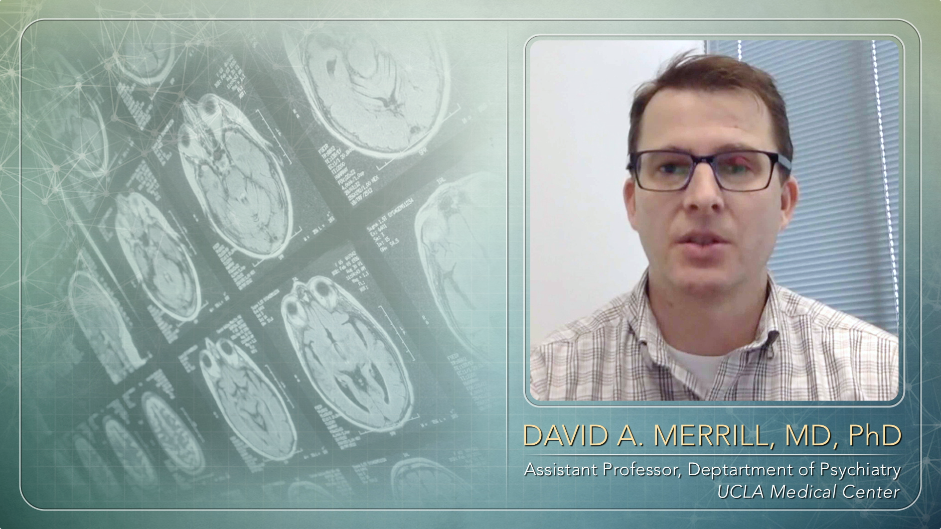 Advanced Neurological Diagnostic Software Helps Physicians Form Better Treatment Plans Thumbnail