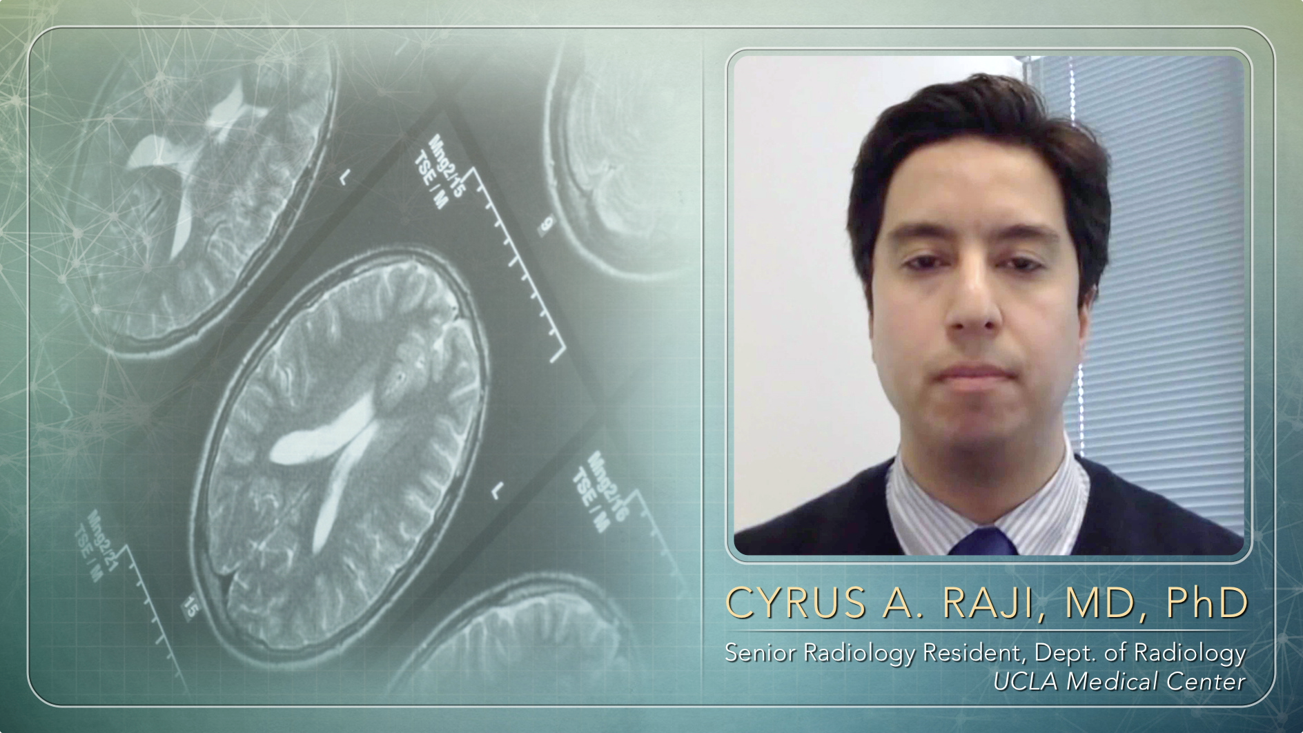 Integrating Neuroimaging Software into Practice and Research Thumbnail