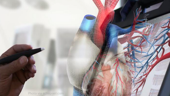 Say Goodbye to Solving 3D Medical Problems on 2D Screens Thumbnail