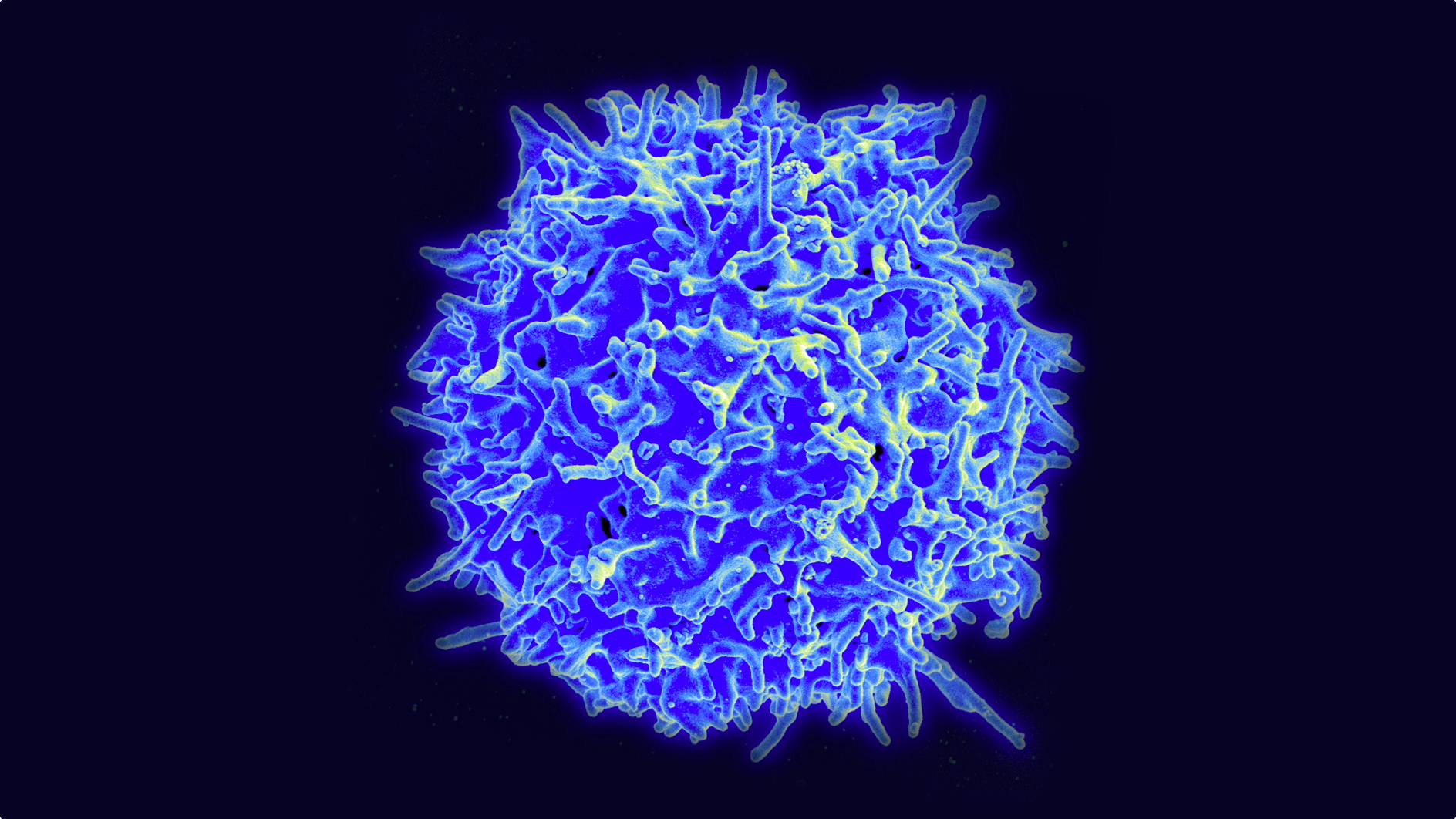 Stem Cell Therapy Helps Combat Epstein-Barr Virus in Immunocompromised Patients Thumbnail