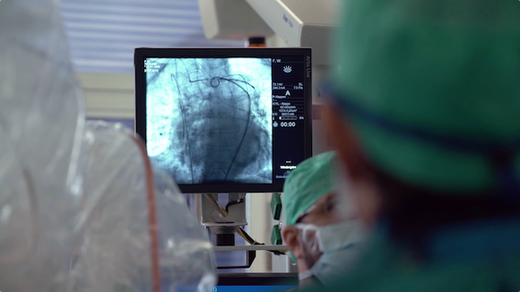 Device Reduces Risk of Brain Injury After Heart Valve Replacement Thumbnail