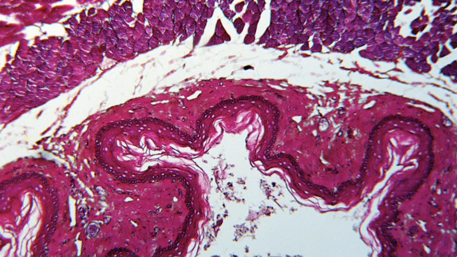 Individualized Care for Prostate Cancer Thumbnail