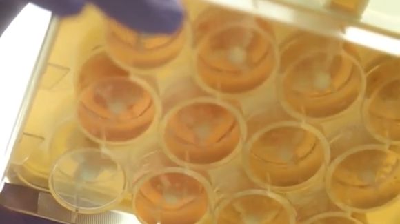 Scientists Identify Two Compounds Capable of Inhibiting Zika Thumbnail