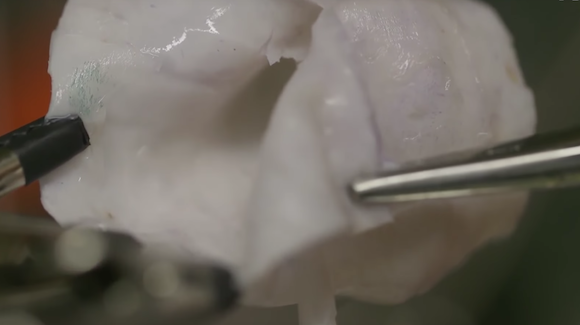 Life-Like Heart Surgery Practice Without the Cadavers or Pigs Thumbnail