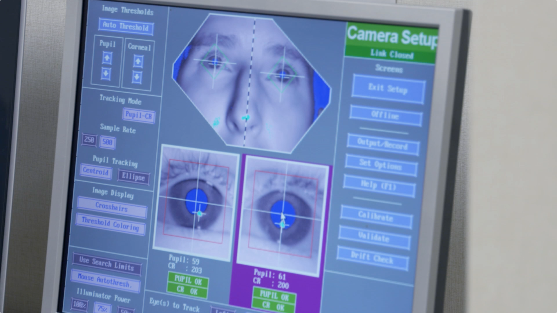 Can an iPad Game Help Treat Lazy Eye in Children? Thumbnail