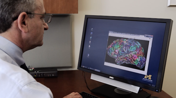 Decline in Prevalence of Dementia in the US Thumbnail