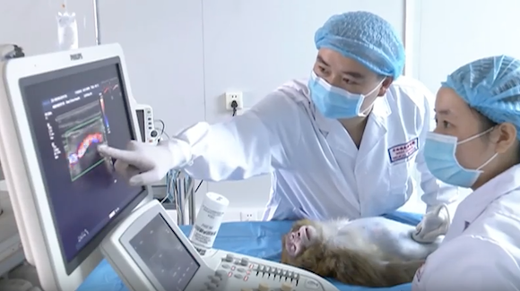 3D-Bioprinting Technique Produces Viable Blood Vessels in Monkeys Thumbnail