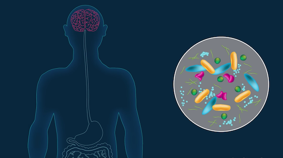 Changes in Microbiome May Be Linked to Parkinson’s Disease Thumbnail