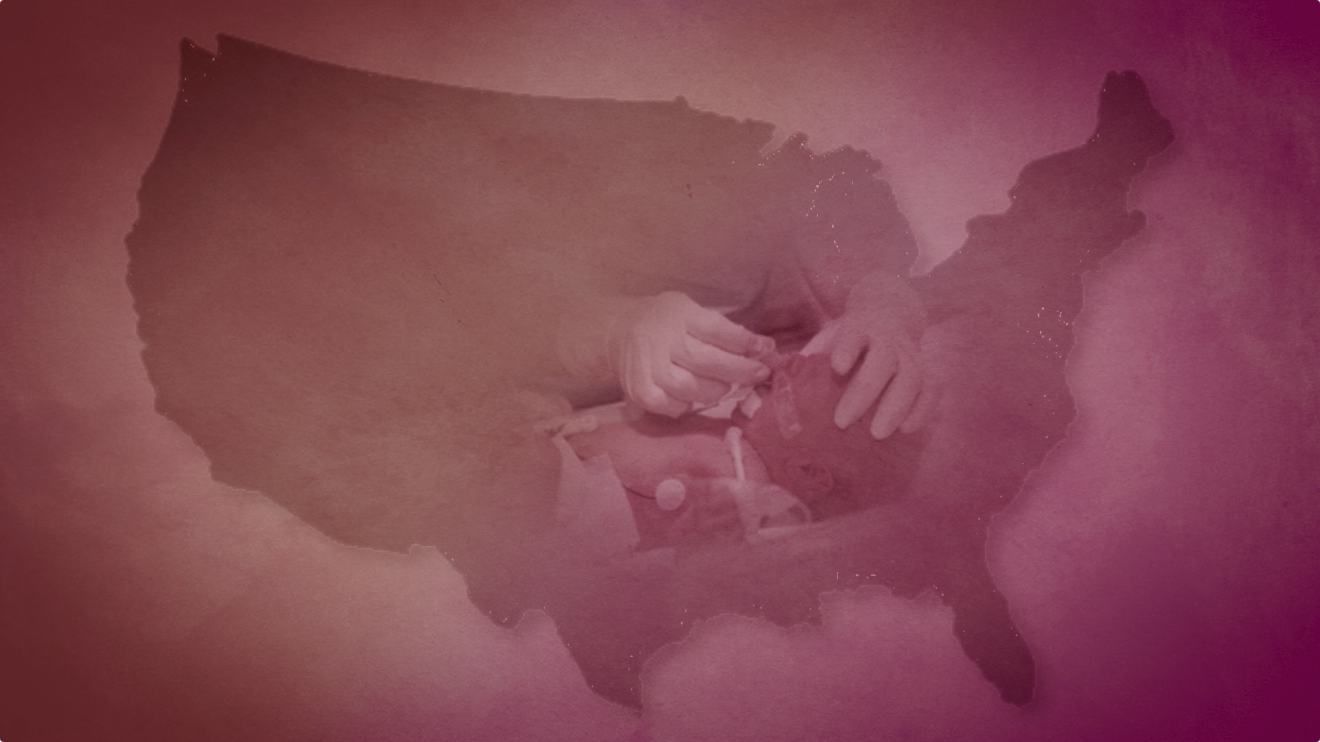 Preterm Births Cost Society Tens of Billions of Dollars Annually Thumbnail