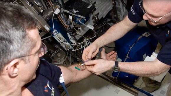 NASA’s “Twins” Study Examines Influenza in Space Thumbnail