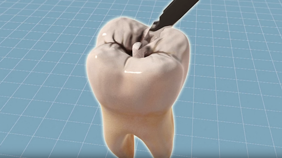 Experimental Drug for Neurological Disorders Helps Regrow Teeth? Thumbnail