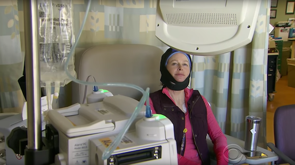 Scalp-Cooling Caps May Prevent Chemotherapy-Induced Alopecia Thumbnail