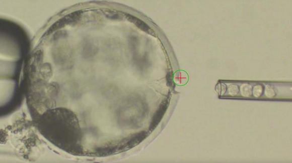 Chimerism Research Hits Milestone with Hybrid Human-Pig Embryo Thumbnail