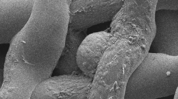 3D-Printed Ovarian Bioprosthesis Overcomes Sterility in Mice Thumbnail