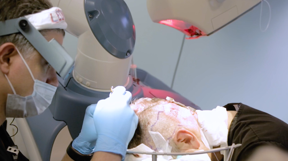 Can a Patient’s Own Blood Revitalize Thinning Hair Follicles? Thumbnail