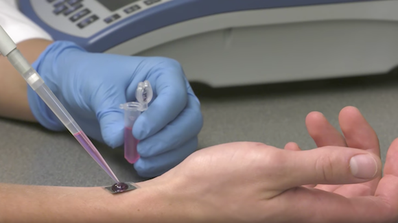 TNT Research Yields Exciting Results for Future Clinical Applications Thumbnail