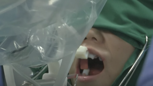 Can Autonomous Robots Solve China’s Dentist Shortage? Thumbnail