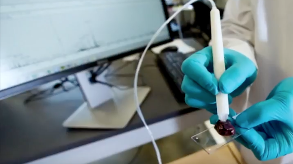 Pen-sized Mass Spectrometer Identifies Cancer During Surgeries Thumbnail