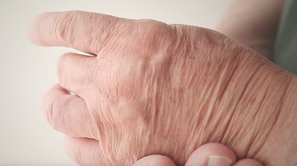 Illustration Test May Spot Parkinson’s Before Motor Symptoms Onset Thumbnail