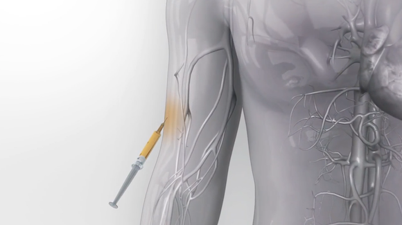 Optimizing the Immune System to Identify and Eradicate Cancer Thumbnail