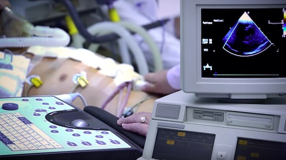 Making Ultrasound Sensors 1,000% More Efficient with Coded Masks? Thumbnail