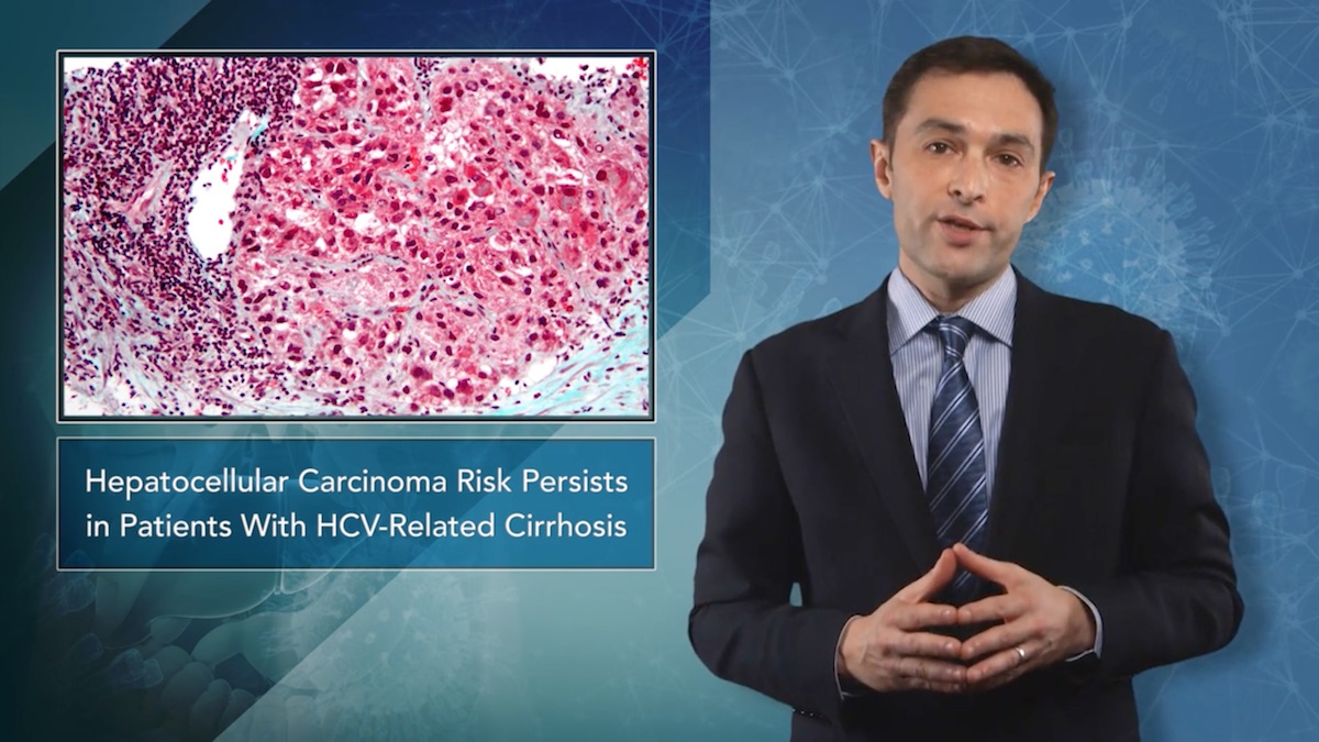 Hepatocellular Carcinoma Risk Persists in Patients With HCV-Related Cirrhosis Thumbnail