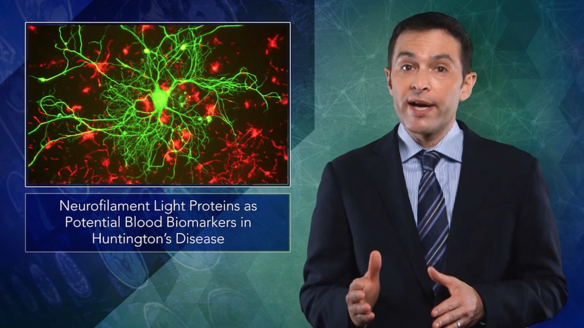 Neurofilament Light Proteins May Identify Onset and Progression in Huntington’s Disease Thumbnail
