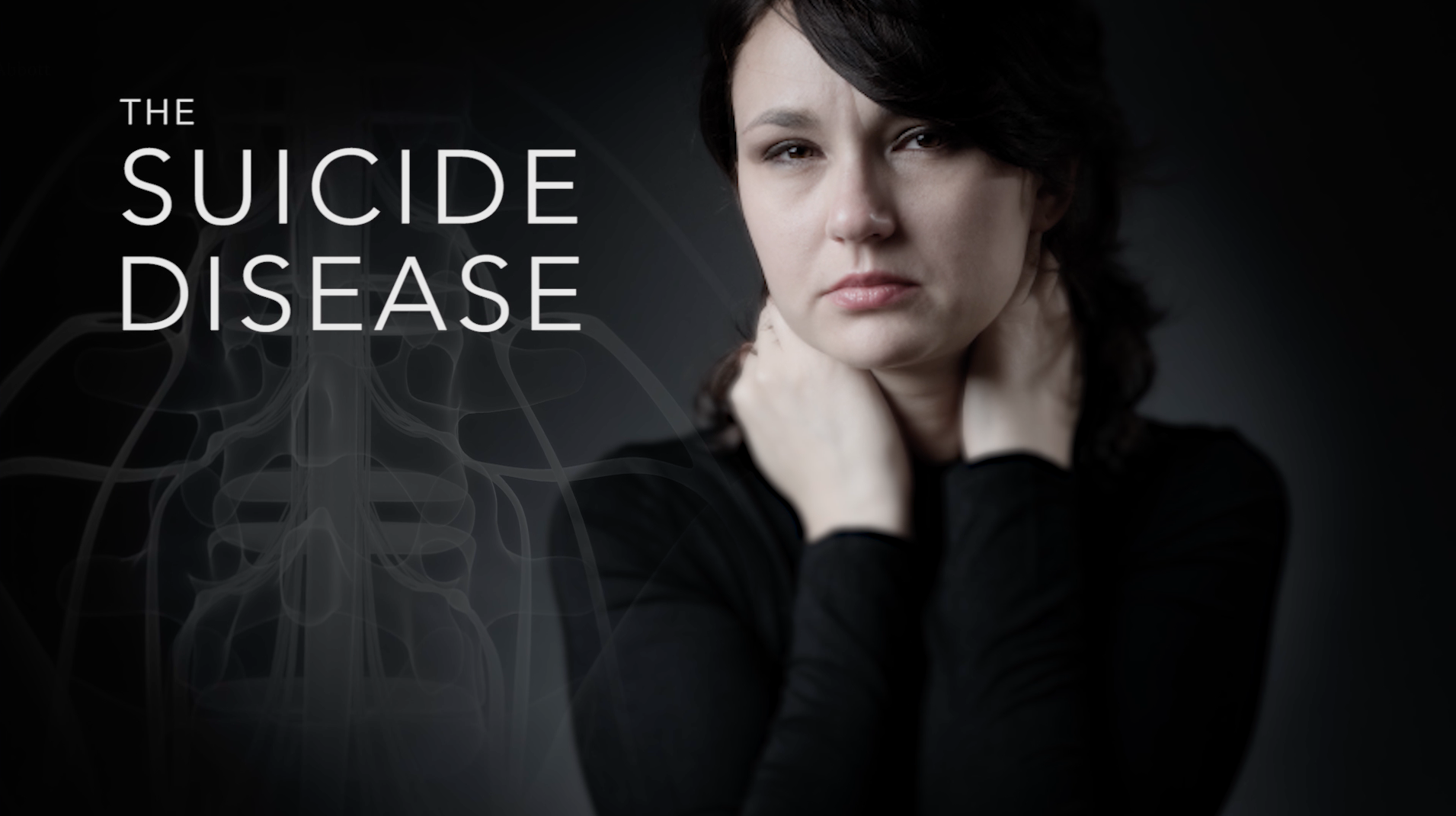Silent Epidemic of Chronic Severe Pain Affects One in Five Americans Thumbnail