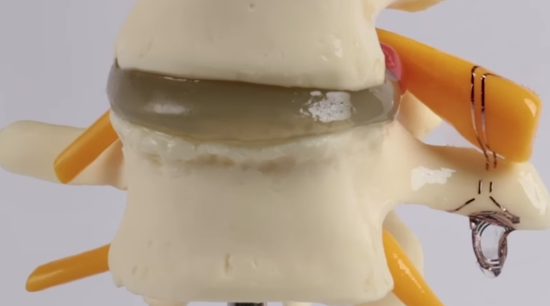 Researchers Develop Bioelectronic Medical Device That Dissolves in the Body Thumbnail
