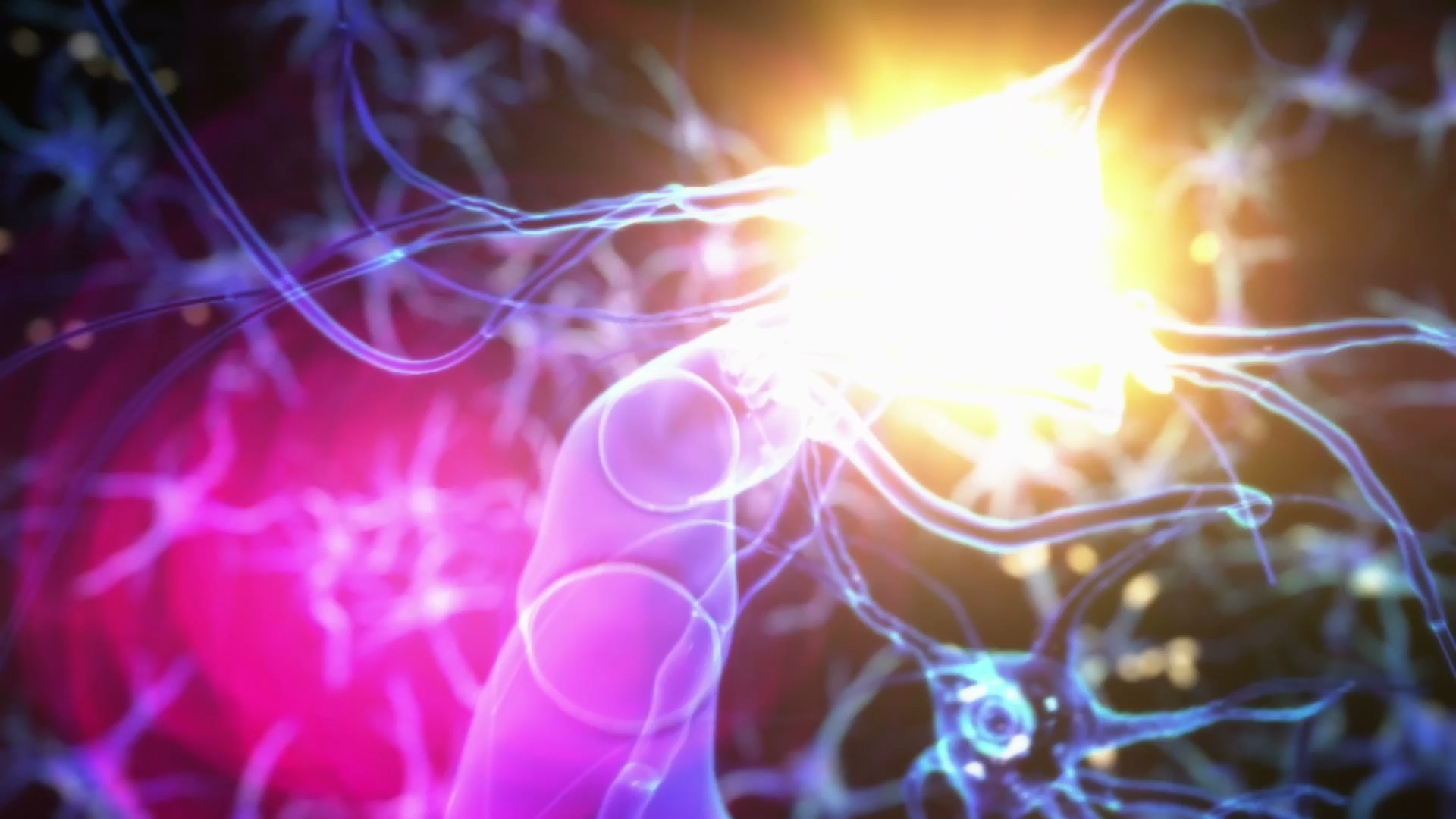 Neuroplasticity and Post-Stroke Care: Achieving Optimal Conditions for Each Patient Thumbnail